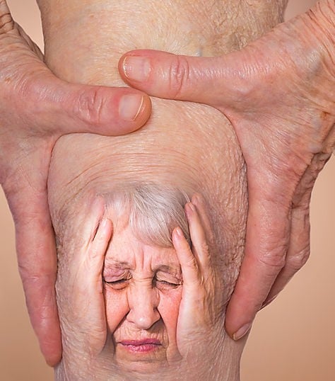 Vorbestehende Arthritis kann Arthrose verursachen