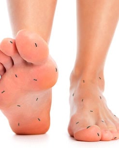 Kribbeln bei Ischiasbeschwerden