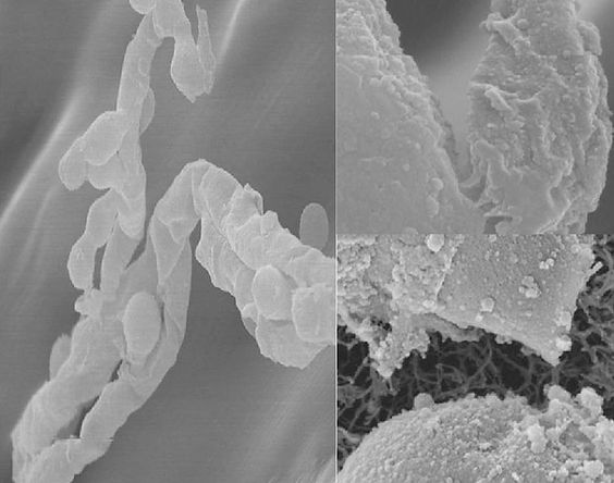 Elektronenmikroskopische Aufnahmen von hif und Zellwandabbau (Rautio et al. 2012)