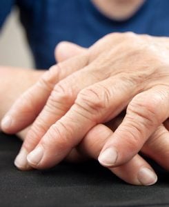 Arthrose kann Schwellungen verursachen