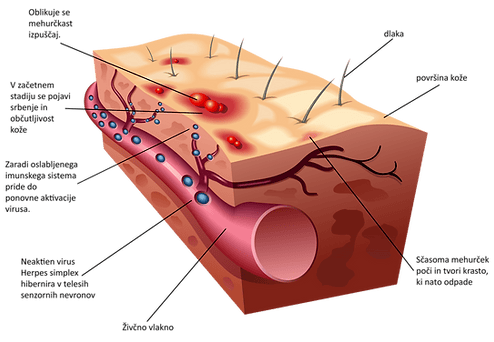 herpes - mehanizem delovanja