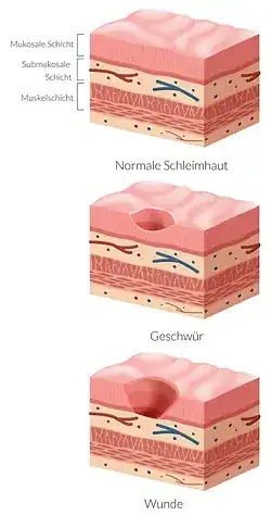 Unterleibsschmerzen aufgrund einer Magenverletzung