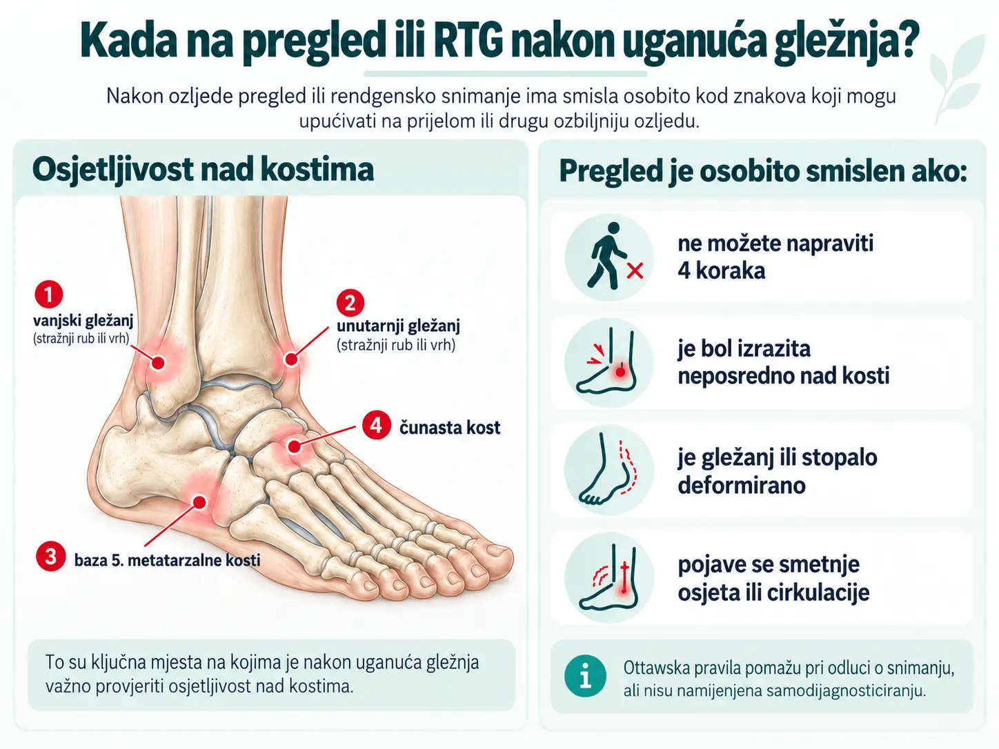 Kada na pregled ili RTG nakon uganuća gležnja: Ottawska pravila i upozoravajući znakovi