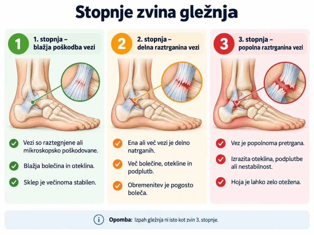 Stopnje zvina gležnja: blažja poškodba vezi, delna raztrganina in popolna raztrganina vezi.